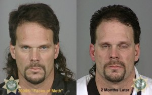 Meth User Before After