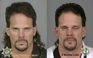 Meth User Before After